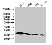 Western Blot Positive WB detected in: recombinant protein All lanes:pagP Antibody at 1:1000 Secondary Goat polyclonal to rabbit IgG at 1/50000 dilution Predicted band size: 21.3 kDa Observed band size: 19 kDa