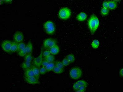 Immunofluorescence staining of PC-3 cells with CSB-PA604514HA01HU at 1:50, counter-stained with DAPI. The cells were fixed in 4% formaldehyde, permeabilized using 0.2% Triton X-100 and blocked in 10% normal Goat Serum. The cells were then incubate...