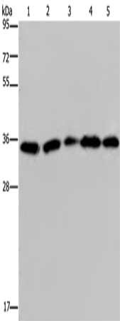 Gel: 10%SDS-PAGE, Lysate: 40 ug, Lane 1-5: Hela cells, Jurkat cells, human placenta tissue, human testis tissue, 231 cells, Primary antibody: CSB-PA605113(OCIAD1 Antibody) at dilution 1/200, Secondary antibody: Goat anti rabbit IgG at 1/8000 dilut...