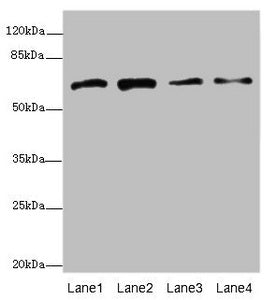 Western blot All lanes: GALNT2 antibody at 4.38µg/ml Lane 1: Hela whole cell lysate Lane 2: Jurkat whole cell lysate Lane 3: HepG2 whole cell lysate Lane 4: A431 whole cell lysate Secondary Goat polyclonal to rabbit IgG at 1/10000 dilution Predict...