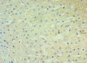 Immunohistochemistry of paraffin-embedded human liver tissue using CSB-PA606010DSR2HU at dilution of 1:100