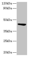 Western blot All lanes: ST3GAL3 antibody at 2µg/ml + Mouse skeletal muscle tissue Secondary Goat polyclonal to rabbit lgG at 1/15000 dilution Predicted band size: 43, 44, 20, 50, 39, 22, 32, 13, 21, 14, 18, 49, 17, 41, 31, 16, 47, 26, 27, 12, 23,...