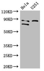 Western Blot Positive WB detected in: Hela whole cell lysate, U251 whole cell lysate All lanes: FCHO2 antibody at 3µg/ml Secondary Goat polyclonal to rabbit IgG at 1/50000 dilution Predicted band size: 89, 44, 86 kDa Observed band size: 89, 86 kDa