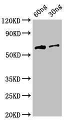 Western Blot Positive WB detected in Recombinant protein All lanes: HA antibody at 3ug/ml Secondary Goat polyclonal to rabbit IgG at 1/50000 dilution predicted band size: 64 kDa observed band size: 64 kDa