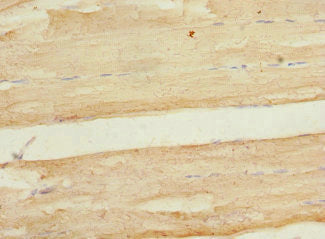Immunohistochemistry of paraffin-embedded human skeletal muscle tissue using CSB-PA609953ESR1HU at dilution of 1:100