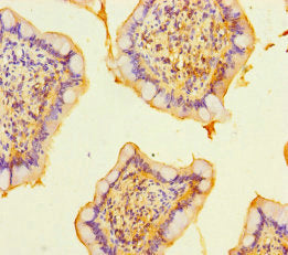 Immunohistochemistry of paraffin-embedded human small intestine tissue using CSB-PA610807LA01HU at dilution of 1:100