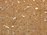The image on the left is immunohistochemistry of paraffin-embedded Human brain tissue using CSB-PA610964(AKAP12 Antibody) at dilution 1/40, on the right is treated with synthetic peptide. (Original magnification: ×200)
