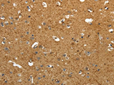 The image on the left is immunohistochemistry of paraffin-embedded Human brain tissue using CSB-PA610964(AKAP12 Antibody) at dilution 1/40, on the right is treated with synthetic peptide. (Original magnification: ×200)
