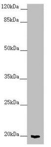 Western blot All lanes: CETN1 antibody at 2.7 ug/ml + Mouse gonadal tissue Secondary Goat polyclonal to rabbit IgG at 1/10000 dilution Predicted band size: 20 kDa Observed band size: 20 kDa