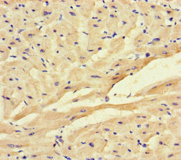 Immunohistochemistry of paraffin-embedded human heart tissue using CSB-PA613266LA01HU at dilution of 1:100