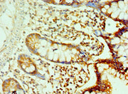 Immunohistochemistry of paraffin-embedded human small intestine tissue using CSB-PA613267ESR1HU at dilution of 1:100