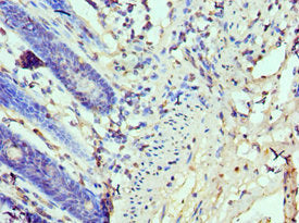Immunohistochemistry of paraffin-embedded human colon tissue using CSB-PA613268ESR1HU at dilution of 1:100