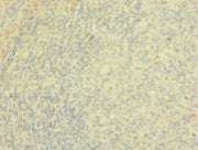 Immunohistochemistry of paraffin-embedded human tonsil tissue using CSB-PA613274ESR1HU at dilution of 1:100