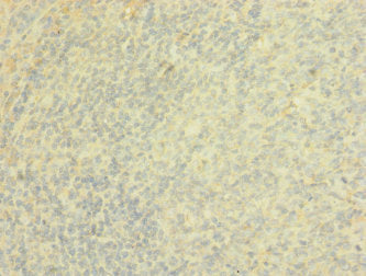Immunohistochemistry of paraffin-embedded human tonsil tissue using CSB-PA613274ESR1HU at dilution of 1:100