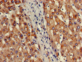 Immunohistochemistry of paraffin-embedded human liver tissue using CSB-PA613379LA01HU at dilution of 1:100