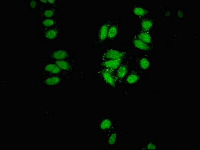 Immunofluorescent analysis of HepG2 cells using CSB-PA613383LA01HU at dilution of 1:100 and Alexa Fluor 488-congugated AffiniPure Goat Anti-Rabbit IgG(H+L)