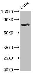 Western Blot Positive WB detected in: Rat lung tissue All lanes: TBX2 antibody at 2.5ug/ml Secondary Goat polyclonal to rabbit IgG at 1/50000 dilution Predicted band size: 76 kDa Observed band size: 76 kDa