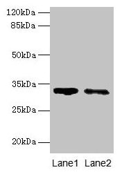 Western blot All lanes: SLA antibody at 5µg/ml Lane 1: 293T whole cell lysate Lane 2: A431 whole cell lysate Secondary Goat polyclonal to rabbit IgG at 1/10000 dilution Predicted band size: 32, 20, 34, 28, 36 kDa Observed band size: 32 kDa