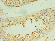 Immunohistochemistry of paraffin-embedded human testis tissue using CSB-PA613388DSR1HU at dilution of 1: 100