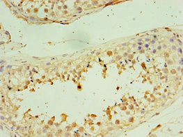 Immunohistochemistry of paraffin-embedded human testis tissue using CSB-PA613388DSR1HU at dilution of 1: 100