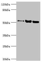 Western blot All lanes: Carbonic anhydrase 1 antibody at 2ug/ml Lane 1: HepG2 whole cell lysate Lane 2: 293T whole cell lysate Lane 3: 293T whole cell lysate Secondary Goat polyclonal to rabbit IgG at 1/10000 dilution Predicted band size: 53, 14 k...