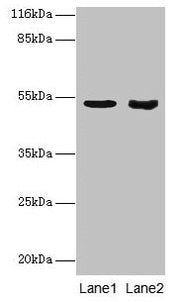 Western blot All lanes: SKP2 antibody at 2µg/ml Lane 1: Jurkat whole cell lysate Lane 2: Hela whole cell lysate Secondary Goat polyclonal to rabbit IgG at 1/10000 dilution Predicted band size: 48, 47, 24 kDa Observed band size: 48 kDa