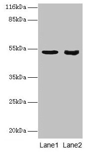 Western blot All lanes: SKP2 antibody at 2µg/ml Lane 1: Jurkat whole cell lysate Lane 2: Hela whole cell lysate Secondary Goat polyclonal to rabbit IgG at 1/10000 dilution Predicted band size: 48, 47, 24 kDa Observed band size: 48 kDa