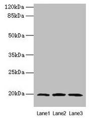 Western blot All lanes: MRPL49 antibody at 0.6µg/ml Lane 1: Colo320 whole cell lysate Lane 2: Mouse liver tissue Lane 3: Mouse kidney tissue Secondary Goat polyclonal to rabbit IgG at 1/10000 dilution Predicted band size: 20 kDa Observed band size...