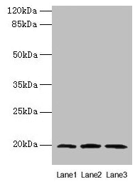 Western blot All lanes: MRPL49 antibody at 0.6µg/ml Lane 1: Colo320 whole cell lysate Lane 2: Mouse liver tissue Lane 3: Mouse kidney tissue Secondary Goat polyclonal to rabbit IgG at 1/10000 dilution Predicted band size: 20 kDa Observed band size...