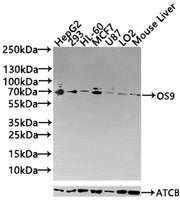 Western Blot Positive WB detected in: HepG2 whole cell lysate, HEK293 whole cell lysate All lanes: OS9 antibody at 3.4µg/ml Secondary Goat polyclonal to rabbit IgG at 1/50000 dilution Predicted band size: 76, 70, 68, 74, 66, 64, 61 kDa Observed ba...