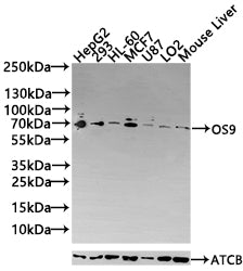 Western Blot Positive WB detected in: HepG2 whole cell lysate, HEK293 whole cell lysate All lanes: OS9 antibody at 3.4µg/ml Secondary Goat polyclonal to rabbit IgG at 1/50000 dilution Predicted band size: 76, 70, 68, 74, 66, 64, 61 kDa Observed ba...