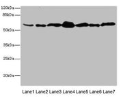 Western blot All lanes: NAE1 antibody at 1.85µg/ml Lane 1: Mouse liver tissue Lane 2: Mouse kidney tissue Lane 3: Mouse skeletal muscle tissue Lane 4: 293T whole cell lysate Lane 5: A431 whole cell lysate Lane 6: K562 whole cell lysate Lane 7: Hel...