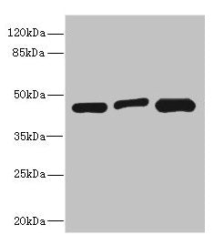 Western blot All lanes: ITPK1 antibody at 3.58µg/ml Lane 1: Hela whole cell lysate Lane 2: HepG2 whole cell lysate Lane 3: A431 whole cell lysate Secondary Goat polyclonal to rabbit IgG at 1/10000 dilution Predicted band size: 46, 36 kDa Observed...