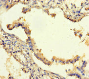 Immunohistochemistry of paraffin-embedded human lung tissue using CSB-PA613413LA01HU at dilution of 1:100