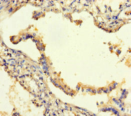 Immunohistochemistry of paraffin-embedded human lung tissue using CSB-PA613413LA01HU at dilution of 1:100