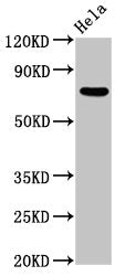 Western Blot Positive WB detected in: Hela whole cell lysate All lanes: MTMR2 antibody at 5.5ug/ml Secondary Goat polyclonal to rabbit IgG at 1/50000 dilution Predicted band size: 74, 66 kDa Observed band size: 74 kDa