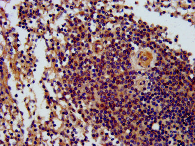 IHC image of CSB-PA613425LA01HU diluted at 1:300 and staining in paraffin-embedded human spleen tissue performed on a Leica BondTM system. After dewaxing and hydration, antigen retrieval was mediated by high pressure in a citrate buffer (pH 6.0)....