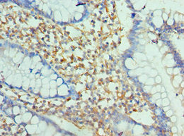 Immunohistochemistry of paraffin-embedded human small intestine tissue using CSB-PA613427ESR1HU at dilution of 1:100