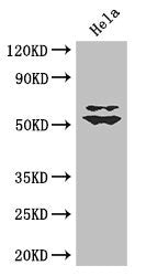 Western Blot Positive WB detected in: Hela whole cell lysate All lanes: KLF5 antibody at 3µg/ml Secondary Goat polyclonal to rabbit IgG at 1/50000 dilution Predicted band size: 51, 34, 19, 42 kDa Observed band size: 51, 60 kDa