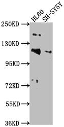 Western Blot Positive WB detected in: HL60 whole cell lysate, SH-SY5Y whole cell lysate All lanes: RAPGEF1 antibody at 1:2000 Secondary Goat polyclonal to rabbit IgG at 1/50000 dilution Predicted band size: 121, 117, 123 kDa Observed band size: 12...