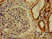 Immunohistochemistry of paraffin-embedded human kidney tissue using CSB-PA613482LA01HU at dilution of 1:100