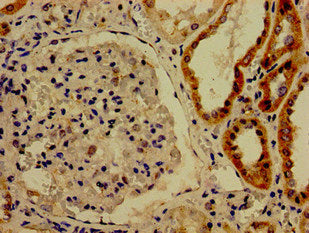 Immunohistochemistry of paraffin-embedded human kidney tissue using CSB-PA613482LA01HU at dilution of 1:100