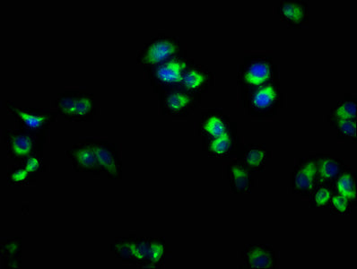 Immunofluorescence staining of PC-3 cells with CSB-PA613485LA01HU at 1:166, counter-stained with DAPI. The cells were fixed in 4% formaldehyde, permeabilized using 0.2% Triton X-100 and blocked in 10% normal Goat Serum. The cells were then incubat...