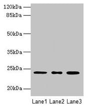 Western blot All lanes: MRPL58 antibody at 2µg/ml Lane 1: A549 whole cell lysate Lane 2: Jurkat whole cell lysate Lane 3: K562 whole cell lysate Secondary Goat polyclonal to rabbit IgG at 1/10000 dilution Predicted band size: 24 kDa Observed band...