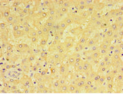 Immunohistochemistry of paraffin-embedded human liver tissue using CSB-PA613493ESR2HU at dilution of 1:100