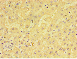 Immunohistochemistry of paraffin-embedded human liver tissue using CSB-PA613493ESR2HU at dilution of 1:100