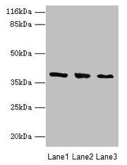 Western blot All lanes: GALE antibody at 2µg/ml Lane 1: HepG2 whole cell lysate Lane 2: Hela whole cell lysate Lane 3: A549 whole cell lysate Secondary Goat polyclonal to rabbit IgG at 1/10000 dilution Predicted band size: 39, 31 kDa Observed band...