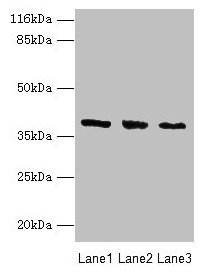 Western blot All lanes: GALE antibody at 2µg/ml Lane 1: HepG2 whole cell lysate Lane 2: Hela whole cell lysate Lane 3: A549 whole cell lysate Secondary Goat polyclonal to rabbit IgG at 1/10000 dilution Predicted band size: 39, 31 kDa Observed band...