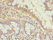 Immunohistochemistry of paraffin-embedded human small intestine tissue using CSB-PA613501ESR1HU at dilution of 1:100