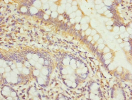 Immunohistochemistry of paraffin-embedded human small intestine tissue using CSB-PA613501ESR1HU at dilution of 1:100